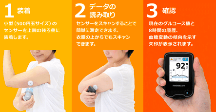 フリースタイルリブレで血糖値を測定してみた——2週間でわかったこと
